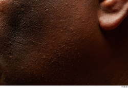 Face Cheek Ear Skin Man Black Overweight Studio photo references